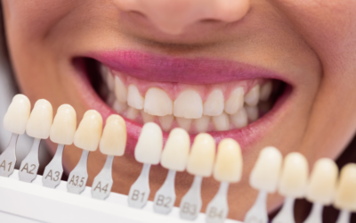 Why More People Are Choosing Full Set of Veneers in Penrith for a Confident Smile