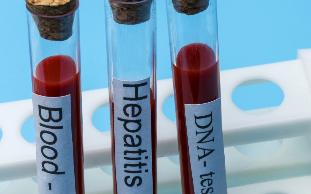 group b streptococcus testing