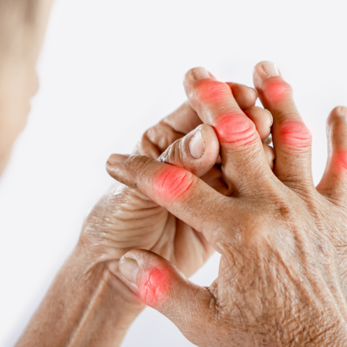 arthritis specialist near me